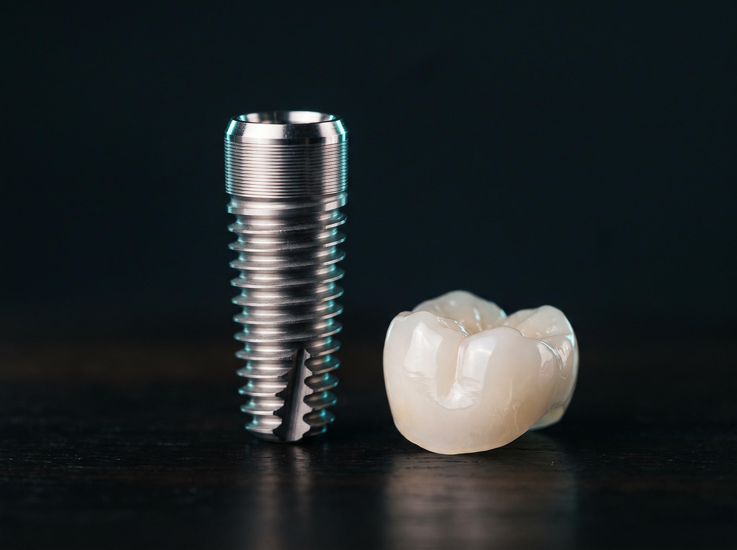 Implante dental de titanio junto a una corona cerámica sobre una superficie oscura